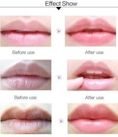 بالم لب وازلین عصاره گل رز Vaseline Lip Therapy ROSY LIPS