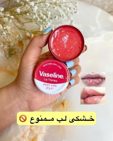بالم لب وازلین عصاره گل رز Vaseline Lip Therapy ROSY LIPS