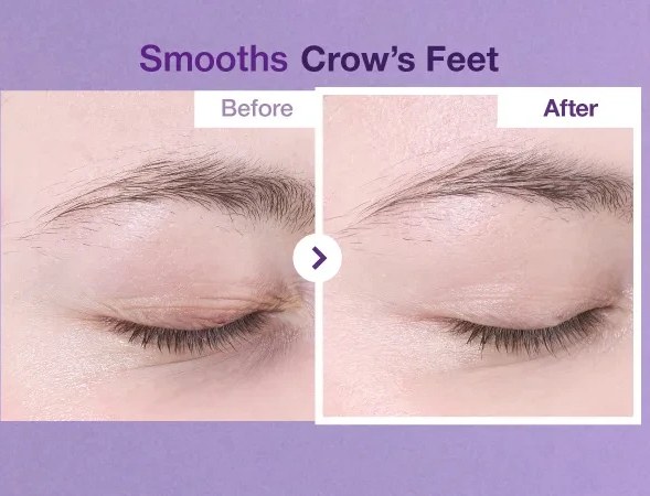 کرم دور چشم نامبوزین مدل No.9 Retinol + NAD+ حجم 10 میلی لیتر
