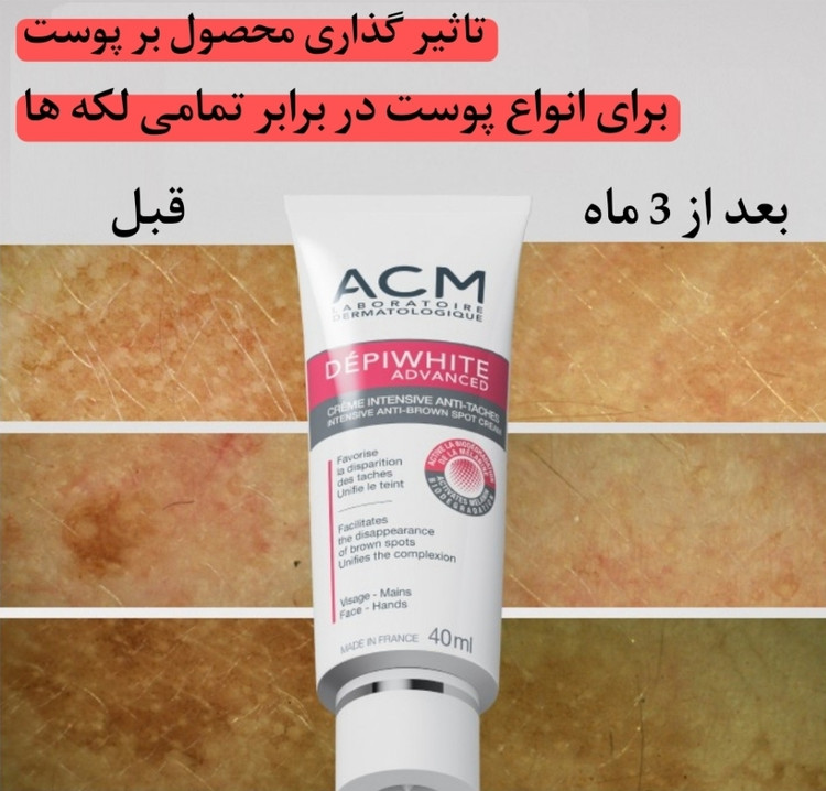 کرم ضد لک دپی وایت ای سی ام حجم 40 میل