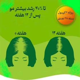 مکمل ضد ریزش مو پریوتین ۱۲۰ عددی)اورجینال)